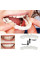 Съемные виниры для зубов Veneers smile, накладные зубы верх и низ в кейсе