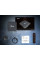 Медиаприставка X98K Android 13 Smart TV с беспроводными модулями Wi-Fi и Bluetooth